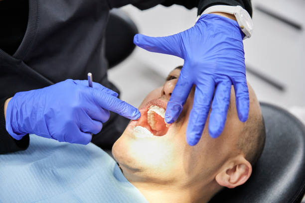 Best Knocked-Out Tooth (Avulsed Tooth) Treatment in Byram, CT